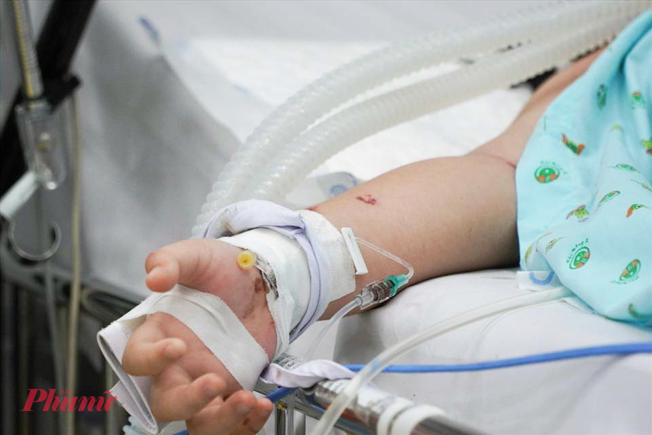 Trẻ mắc sốt xuất huyết điều trị tại Bệnh viện Nhi đồng 2 TPHCM, ảnh Phạm An